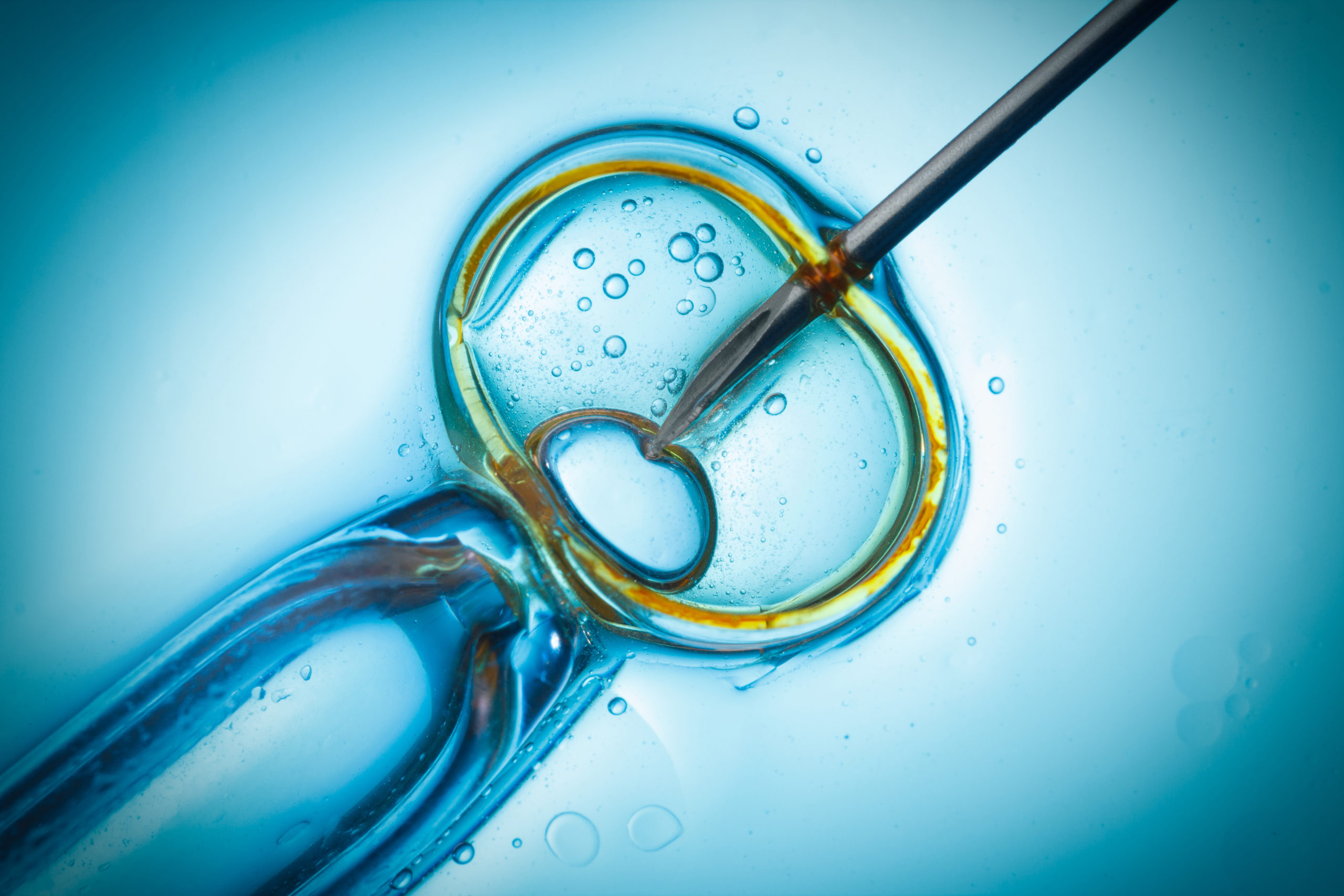 Close-up of an in vitro fertilization (IVF) procedure with a pipette and a human egg.